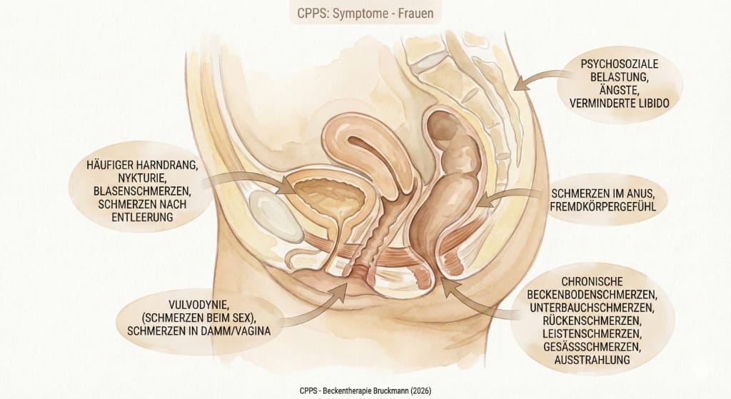 CPPS-Symptome: Frauen - Praxis Bruckmann (2026)